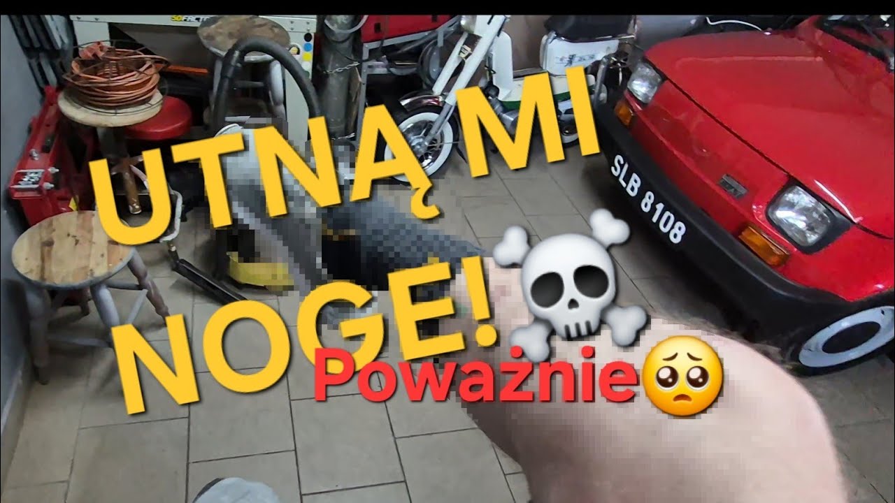DLACZEGO UTNĄ MI NOGĘ 😱😭