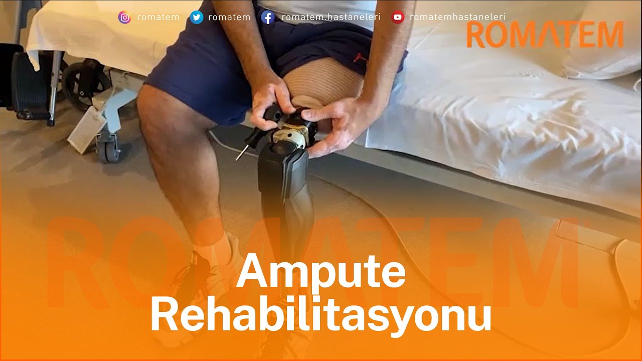 Ampute (Amputasyon) Hastalarda Rehabilitasyon | Hasta Hikayesi