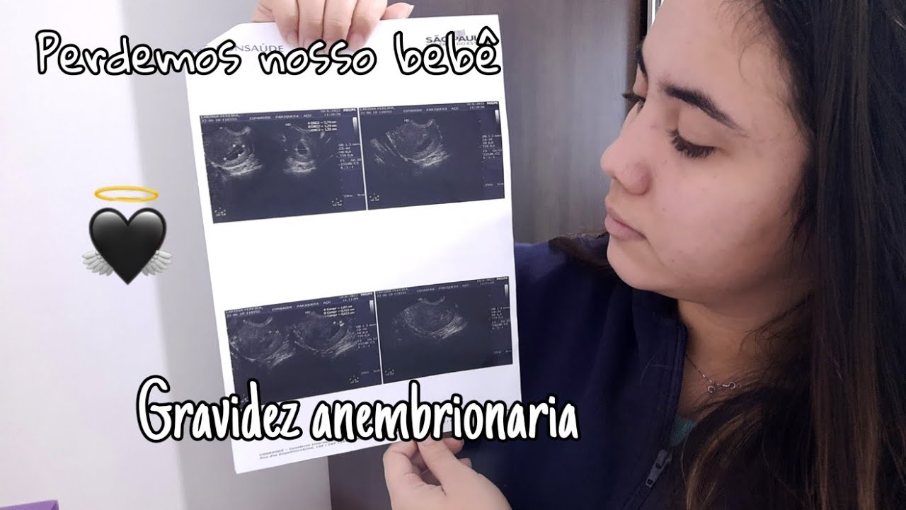 Nossa gravidez não evoluiu - Gravidez Anembrionaria 👼🏻😔