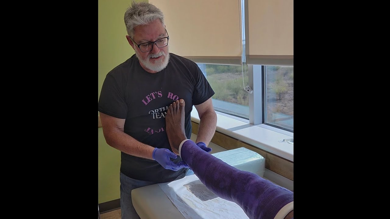 How to Make a Fiberglass Cylinder Long Leg Cast