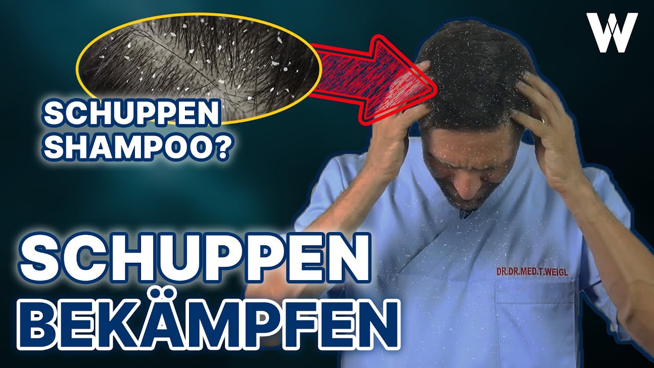 Schuppen & juckende Kopfhaut: Lösung gesucht | Was können Shampoo, Waschen, Ernährung & Hausmittel?