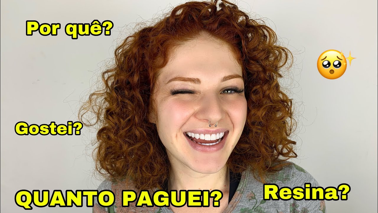 COLOQUEI LENTES DE RESINA!! 🦷😍