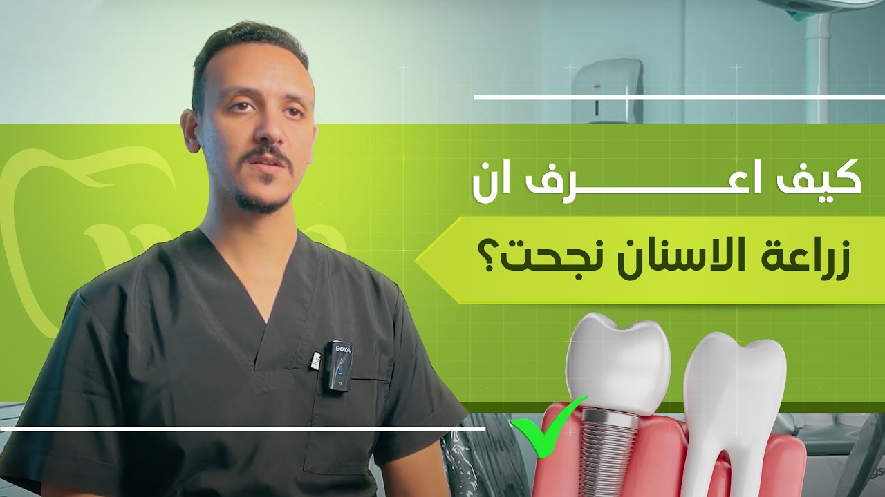 كيف اعرف ان زراعة الاسنان نجحت؟