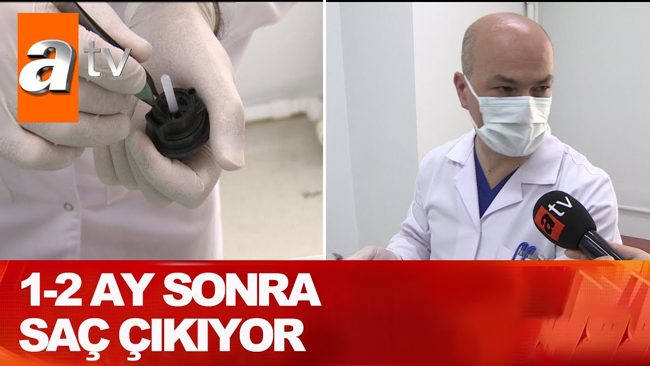 Saç dökülmesine çare! - Atv Haber 1 Mayıs 2021