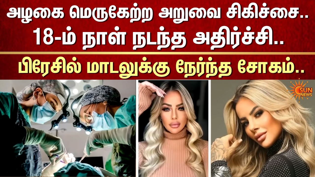 Beauty Surgery | Brazilian Female Model | Shocking Incident | FIR | Sun News