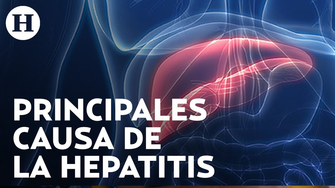 ¿Conoces los síntomas y causas que provoca la hepatitis?