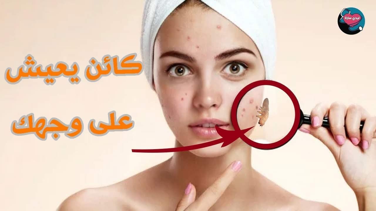 Ошибка (Demodex) живет на вашем лице