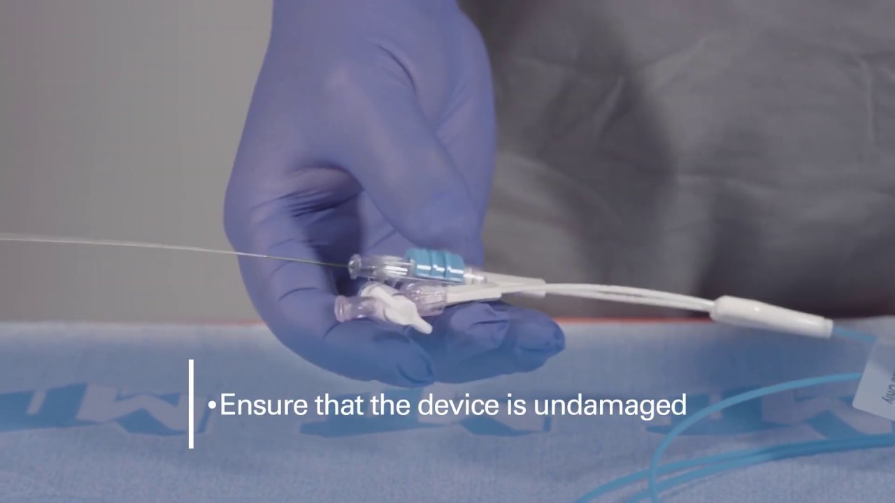 Reliant Multi-Stage Balloon Catheter Tutorial