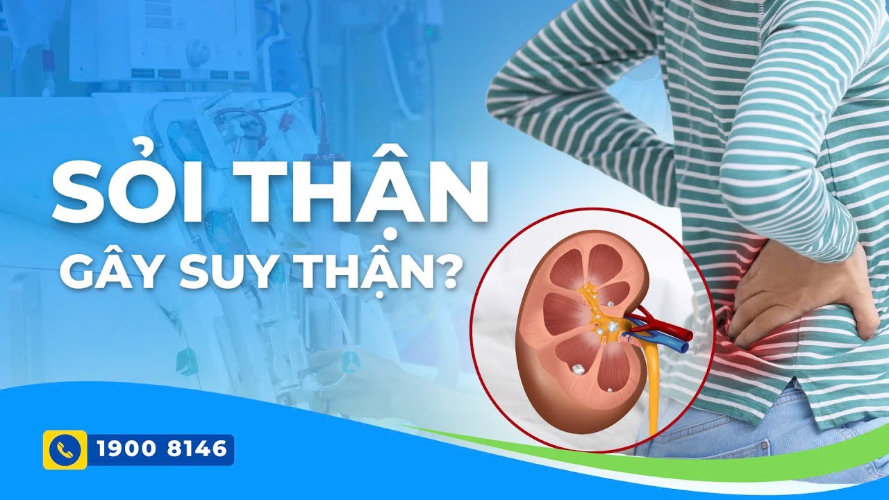 Sỏi thận có khả năng gây suy thận không?