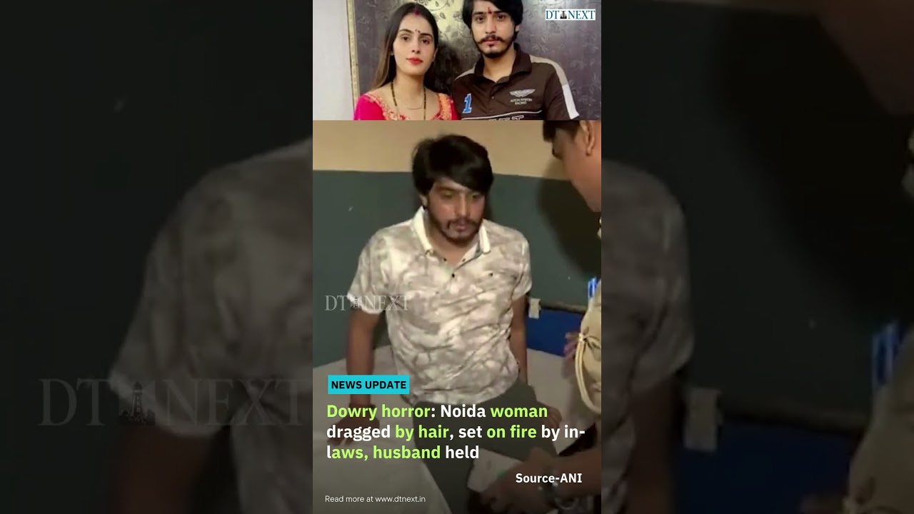 Dowry horror: Noida woman dragged by hair, set on fire by in-laws, husband held