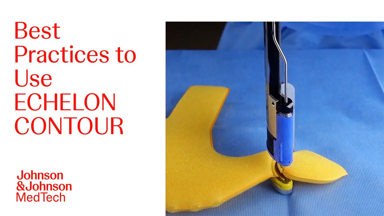 How to Setup ECHELON CONTOUR Curved Cutter For Better Staple Line Formation | J&J MedTech