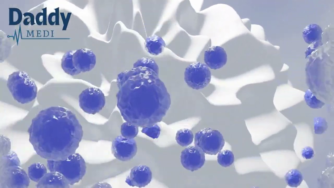 Essential Thrombocythemia ET and the New Antibody Treatment