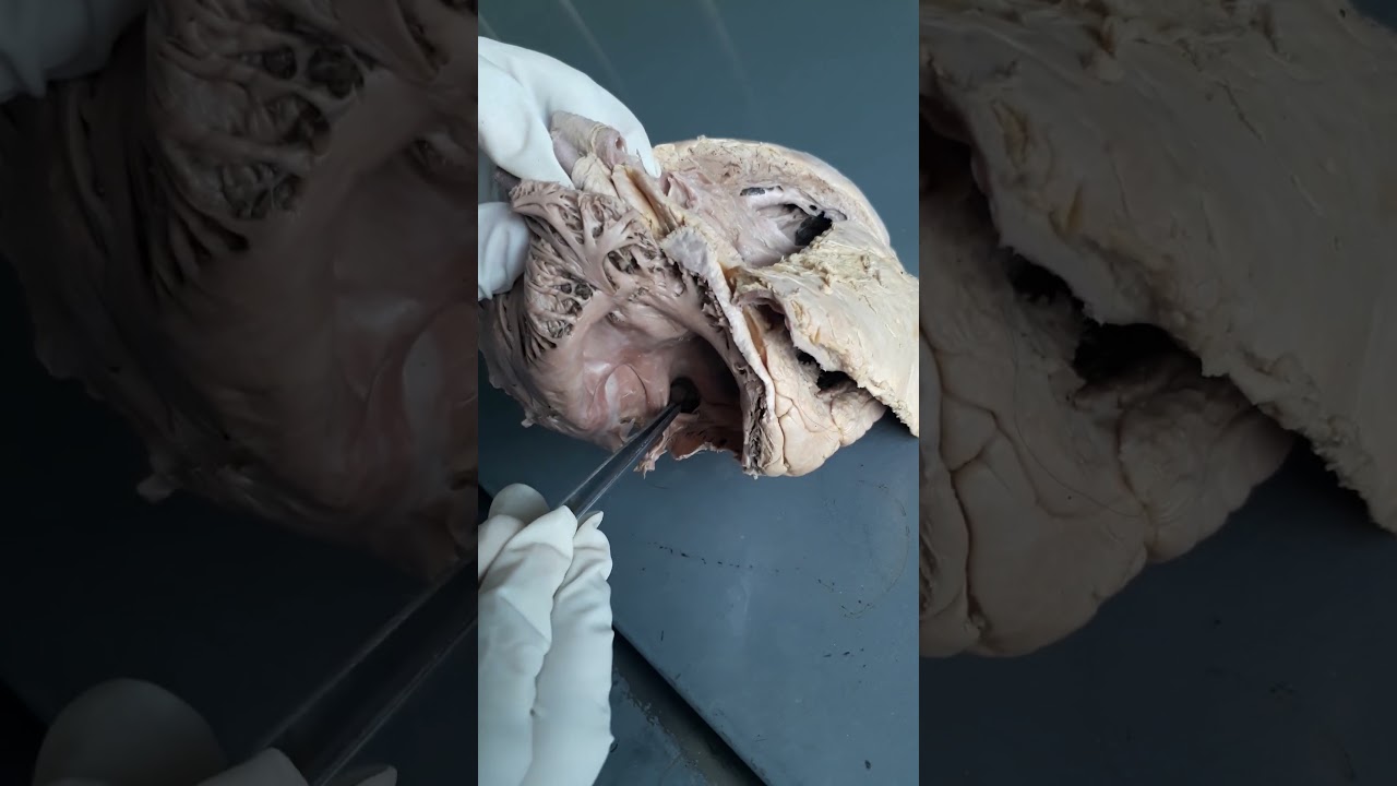 Interior of right atrium