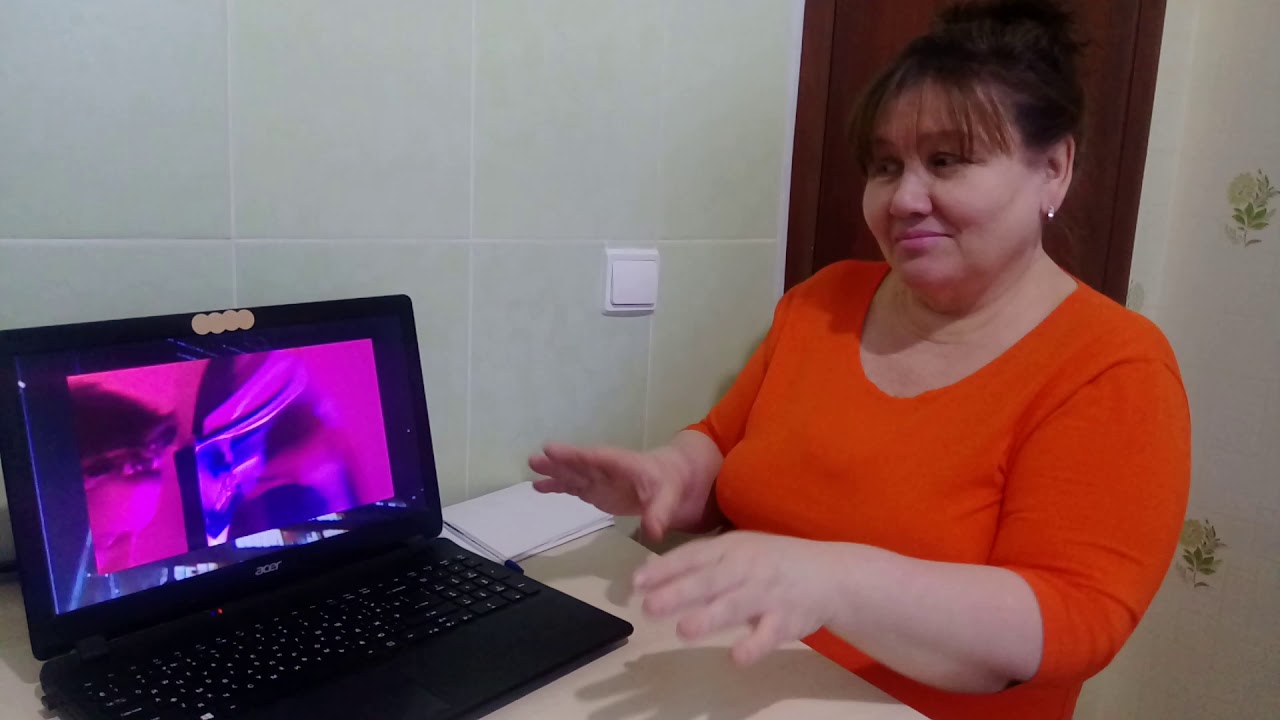 РЕАКЦИЯ НА ПЛАТИНА - ИНЕЙ