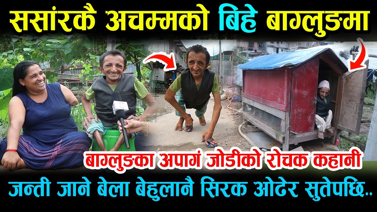 संसारकै अनौठो बिहे, जन्ती बेहुली लिन बेहुला सिरक ओढेर बिस्तारामा ,अपांग जोडीको रोचक कहानी Baglung