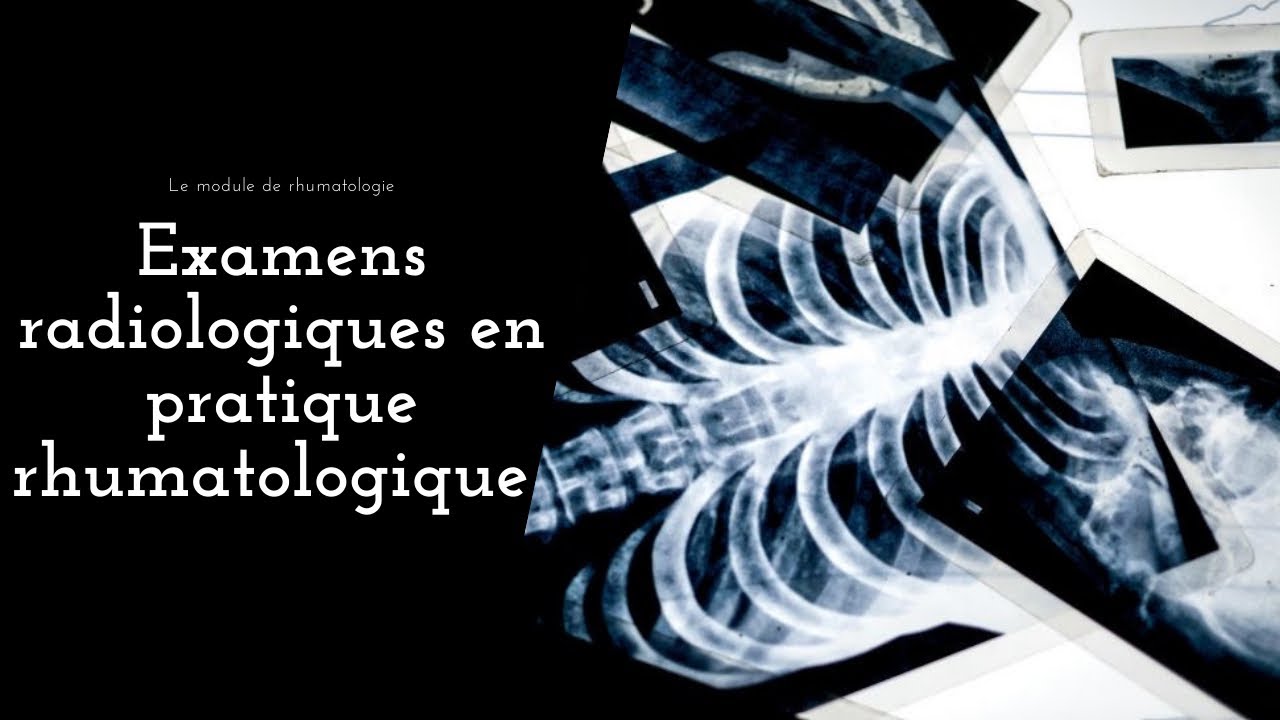Les examens radiologiques en rhumatologie