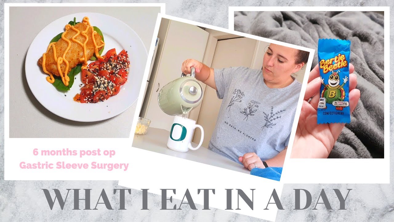 What I eat in a day | 6 Months Post Gastric Sleeve Surgery