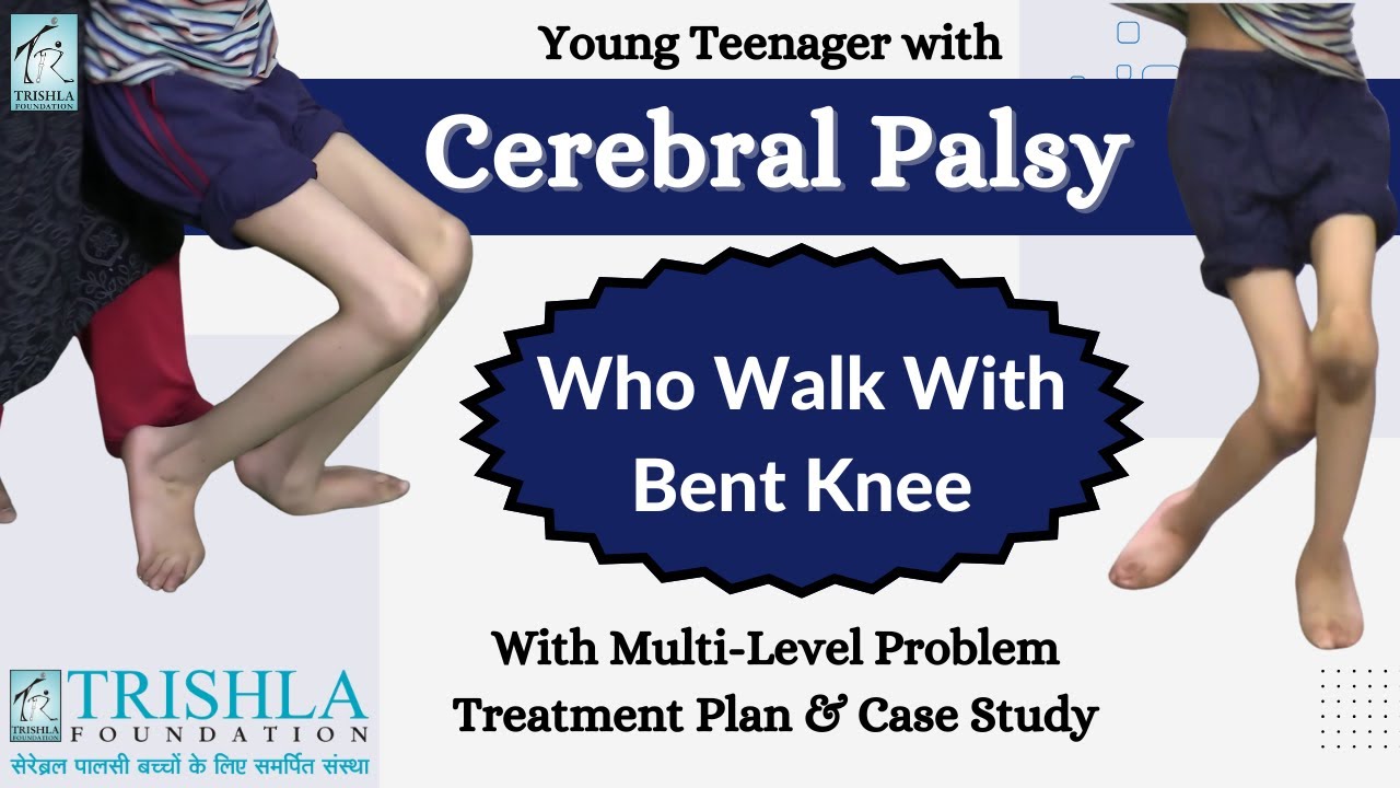 Cerebral Palsy Teenager with Multilevel Problem, Walked with Bent Knees: Treatment plan & Case study
