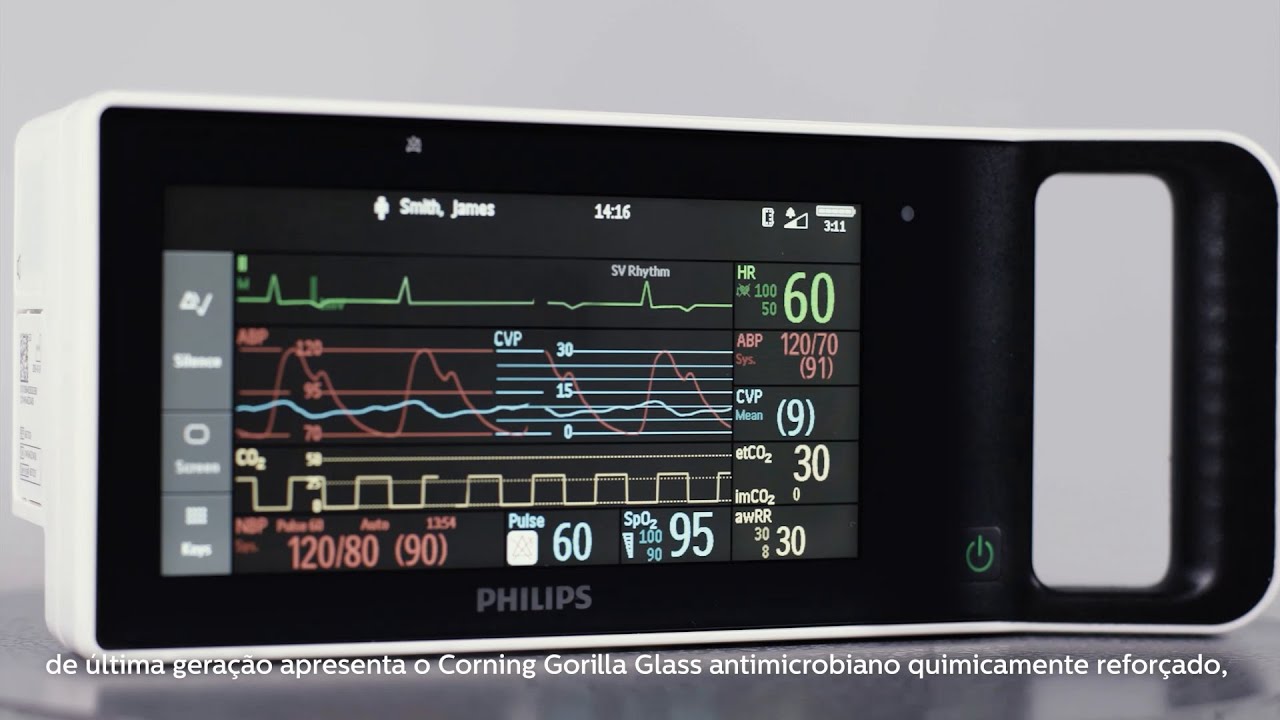 Monitoramento | Conhe&ccedil;a o IntelliVue