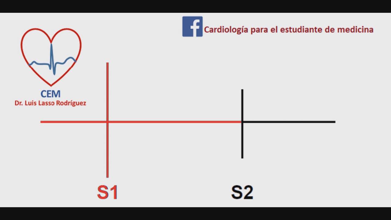 Auscultaci&oacute;n del primer ruido card&iacute;aco normal