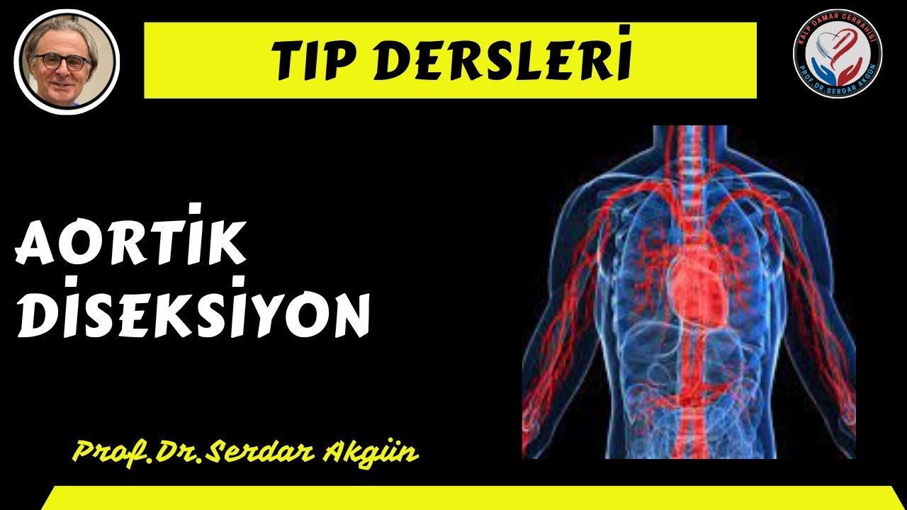Aort Diseksiyonları, VadeMecum, Tıp Dersleri, Serdar Akgün