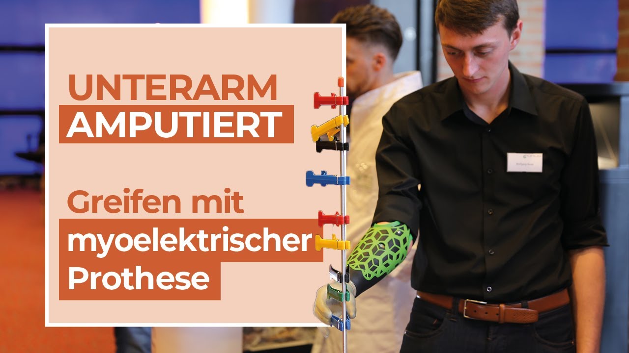 Amputation am Unterarm | Wolfgang experimentiert mit myoelektrischer Armprothese