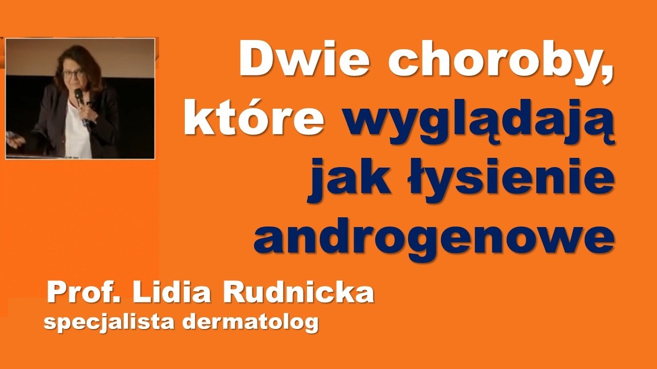 Dwie choroby, kt&oacute;re wyglądają jak łysienie androgenowe