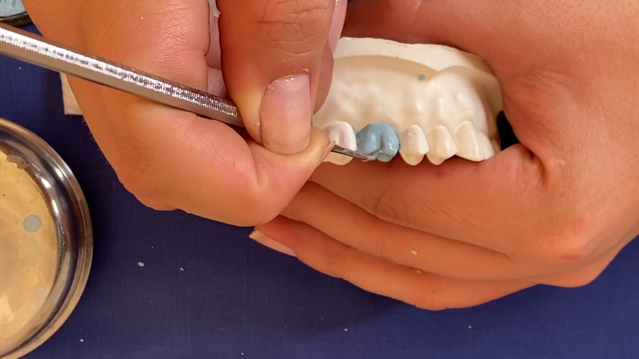 Encerado de un primer molar superior FACIL!, Paso a paso / upper first molar wax up