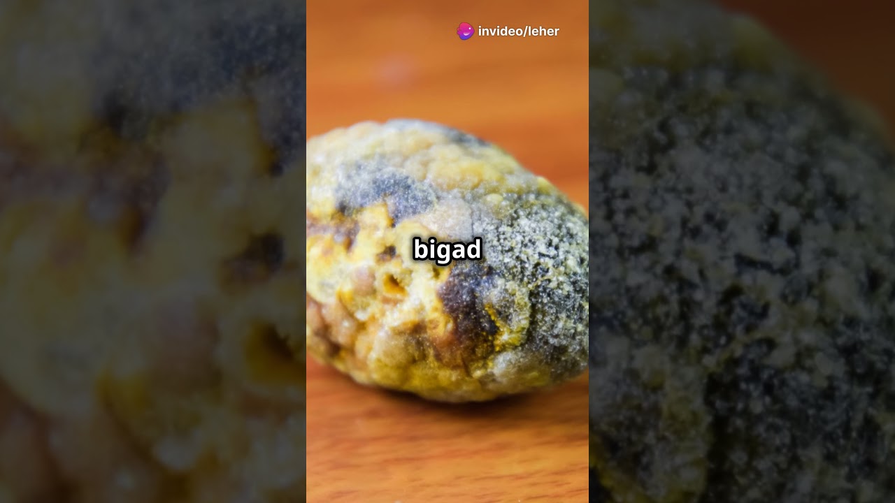 Gallstones Pathophysiology #Cholelithiasis #MedicalShorts #IndianMedicalStudents #MedicalEducation