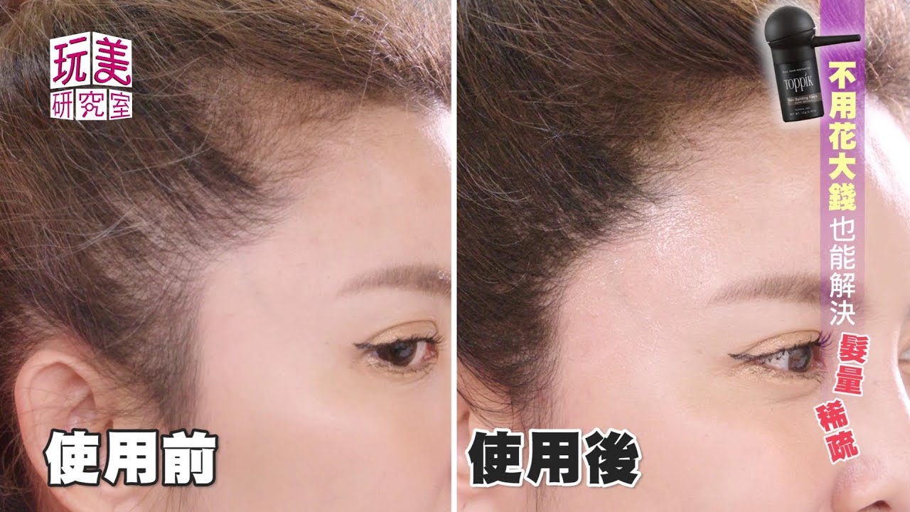 搶救髮際線稀疏 讓髮神吳依霖老師救救你 頂豐Toppik增髮纖維【玩美研究室】