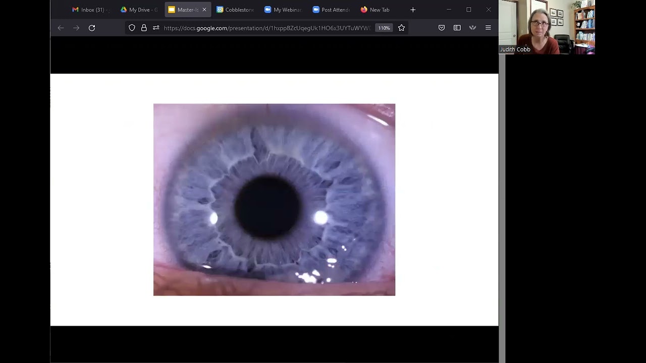 How to do an iris assessment and program creation in client appointments