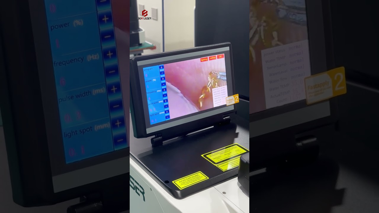 Gold Chain Laser Welding Machine | Jewelry Repair & Joining Demo