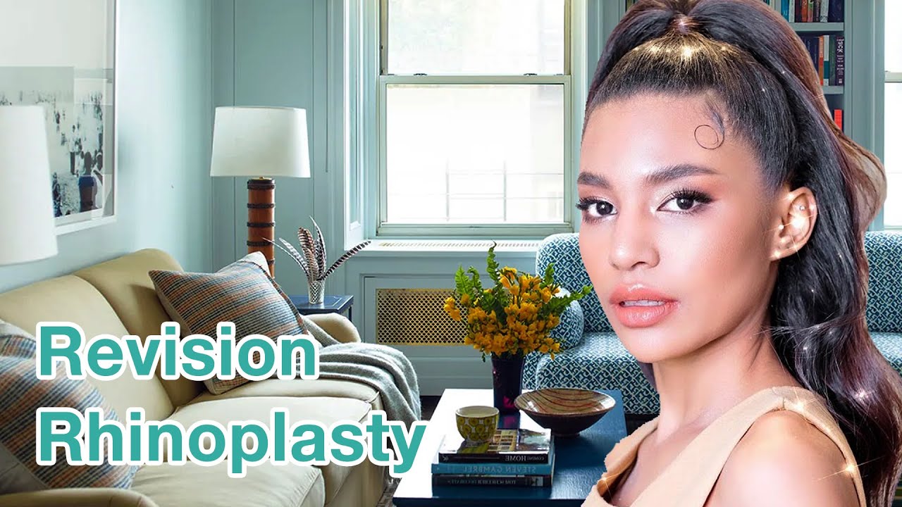 Revision Rhinoplasty Experience by Indy Johnson