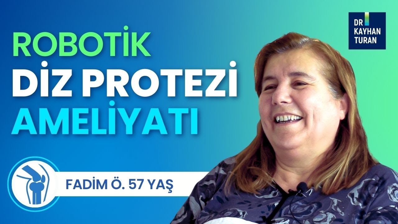 Fadim Ö. 57 yaşında- İki dizde Robotik Diz protezi ameliyatı yapıldı ve ertesi gün ayağa kalktı.