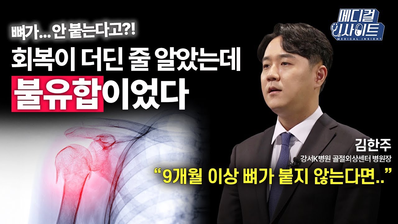 뼈가... 안 붙는다고?! 회복이 더딘 줄 알았는데 불유합이었다.ㅣ메디컬 인사이트[84회] / YTN2U