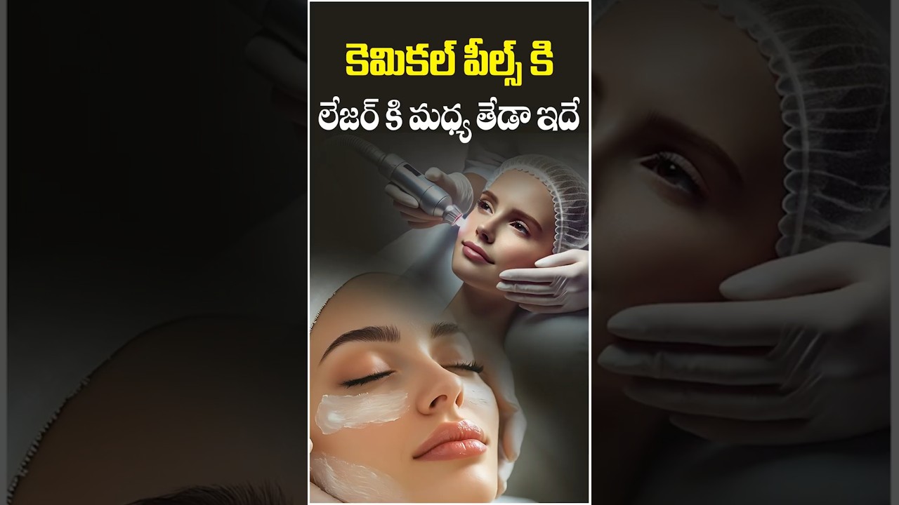 Chemical Peel vs Laser: Which Is Better for Your Skin? | Sriroop Cosmetic Clinics 