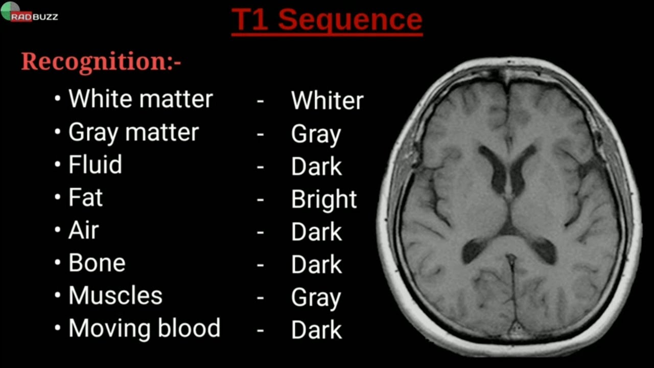 MRI Sequences  || Radiology Buzz