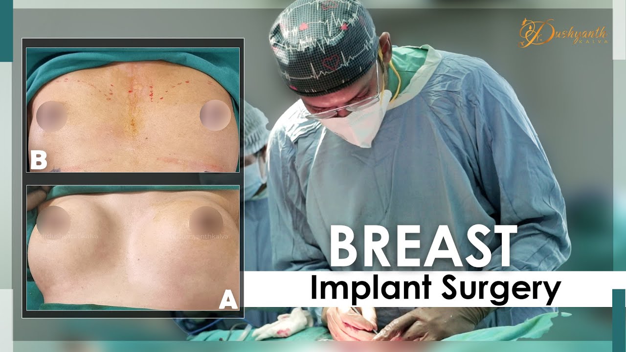 Breast Implant Surgery