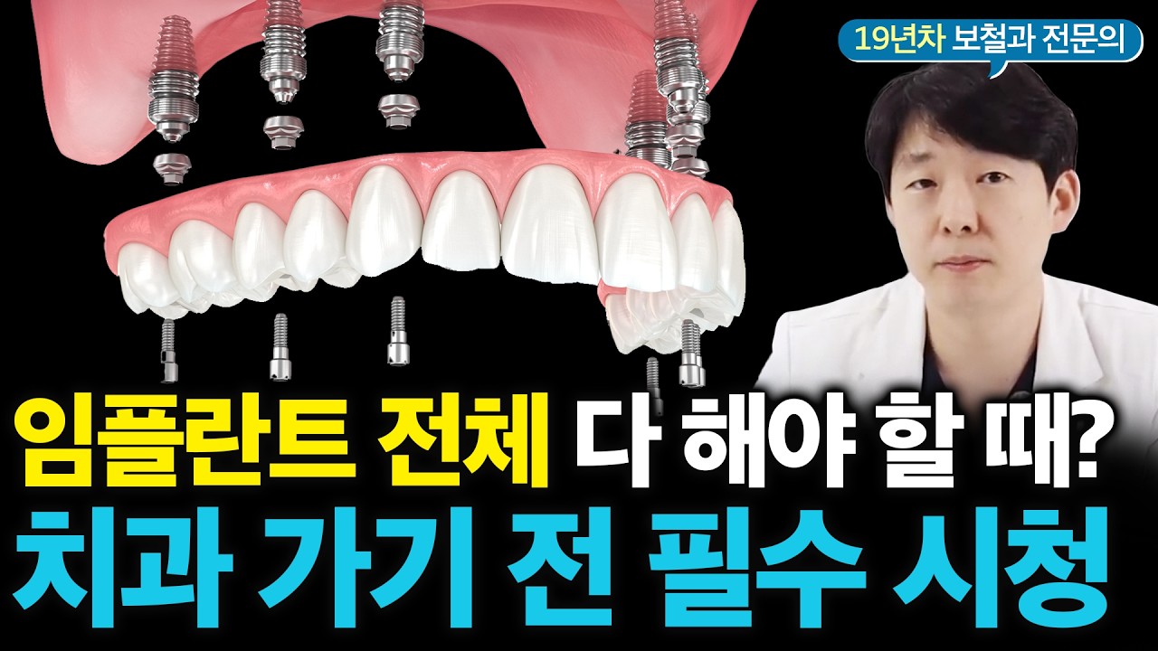 전체 임플란트! 틀니 하기 싫다면 이것만은 알고 하세요 (#풀아치임플란트)