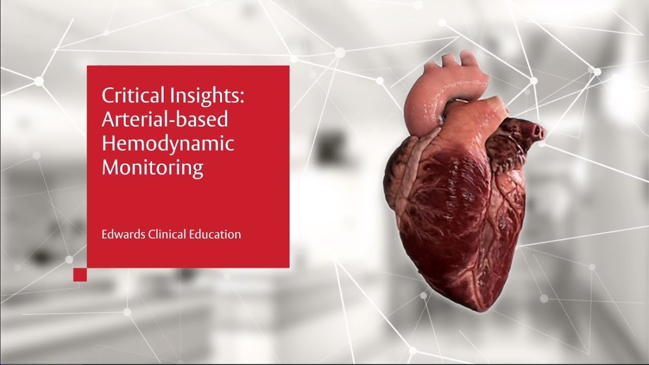 Critical Insights: Arterial Based Hemodynamic Monitoring