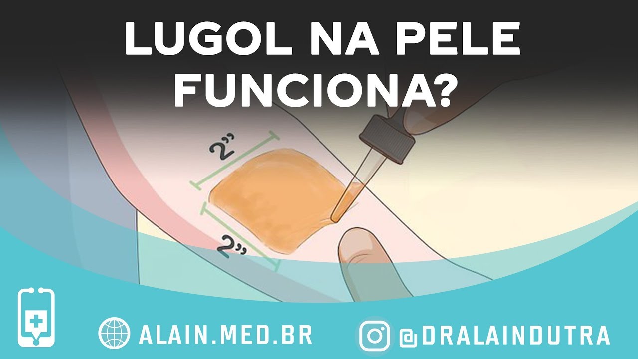 Devemos usar lugol na pele ? O teste de absorção na pele funciona ?