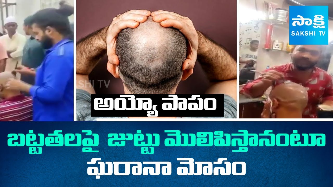 Baldness Cure:Shocking Facts Revealed About Old City Vakil Salon Shop,Hair Loss Treatment