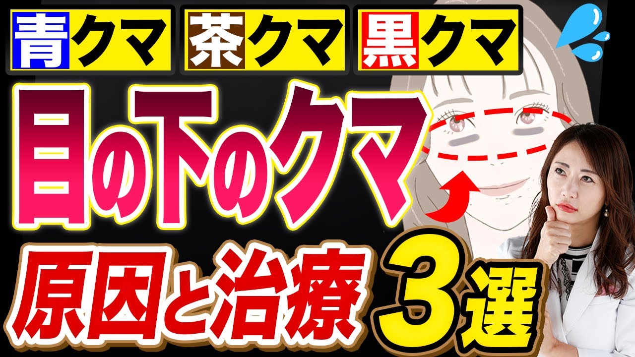 【クマ取り】目の下のくま（青クマ、茶クマ、黒クマ）の原因と消し方、治療方法について皮膚科医がわかりやすく解説！