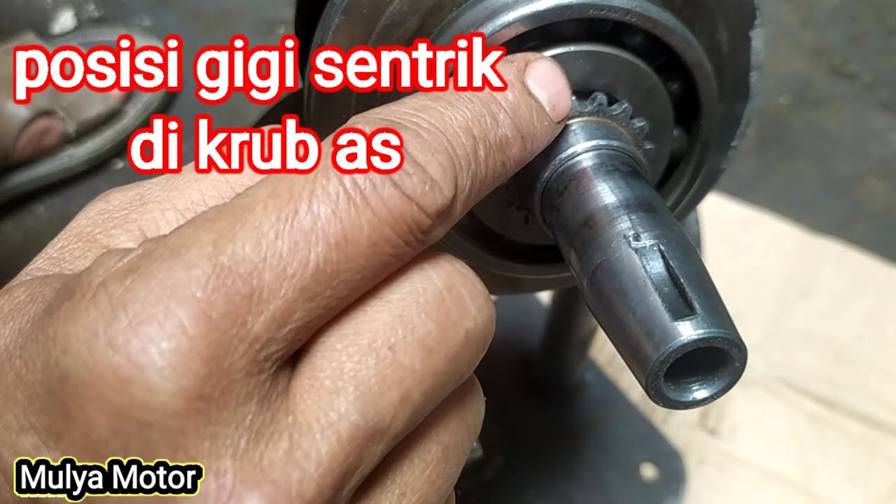 pososi gigi sentrik keteng di krub as.
