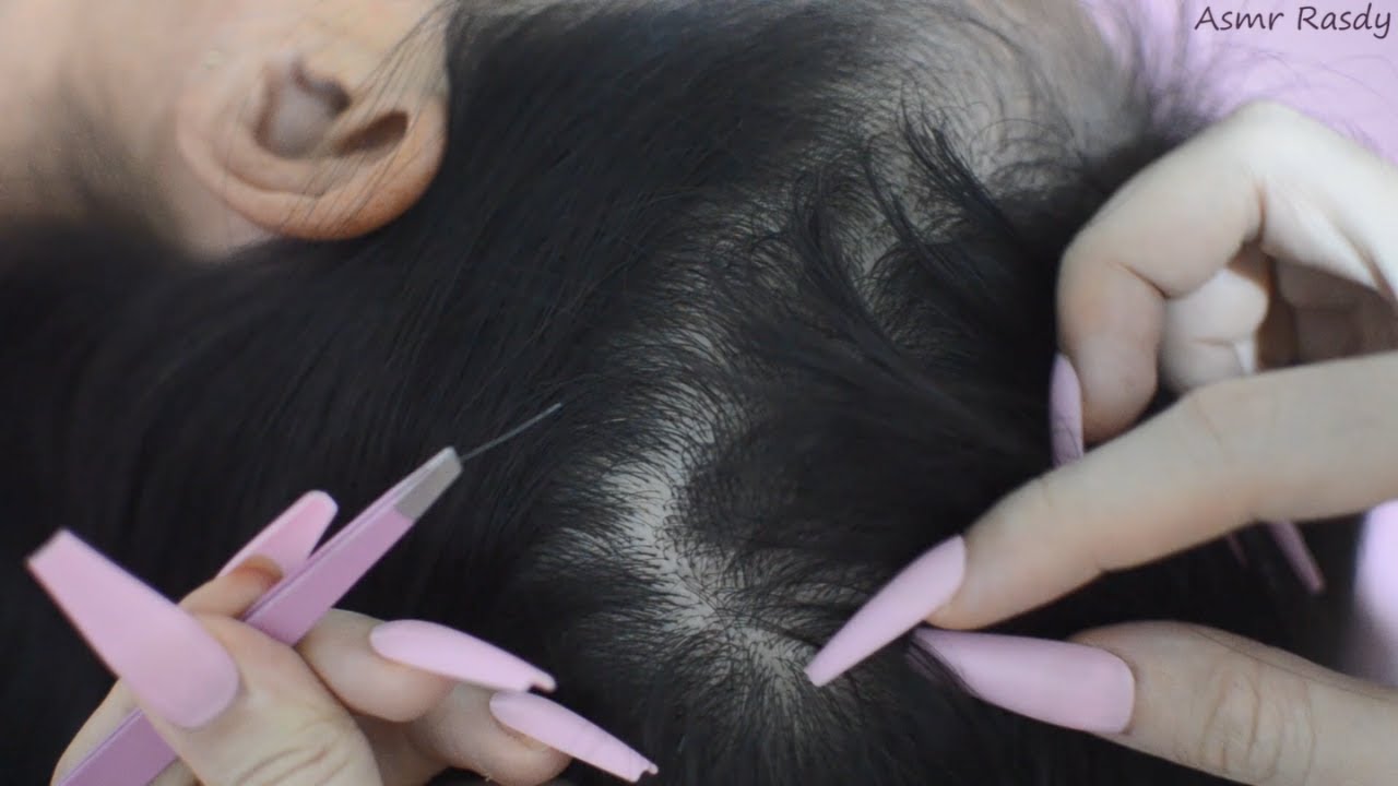 ASMR Scalp Check With Tweezers, Scalp Picking, Grey Hair Plucking For Relieve Stress ( No Talking )