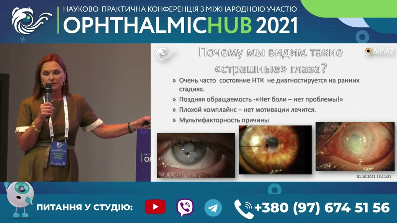 От роговицы до сетчатки: нейротрофические кератиты