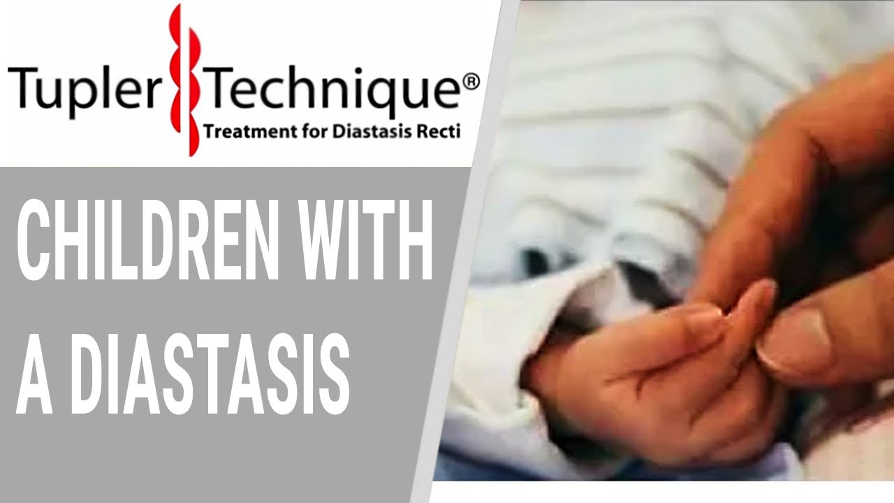 Children With a Diastasis-Julie Tupler, RN