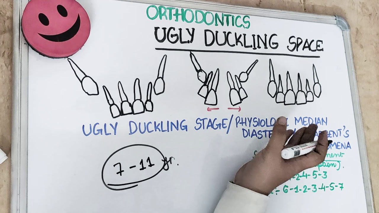 ugly duckling stage of teeth - dental lessons