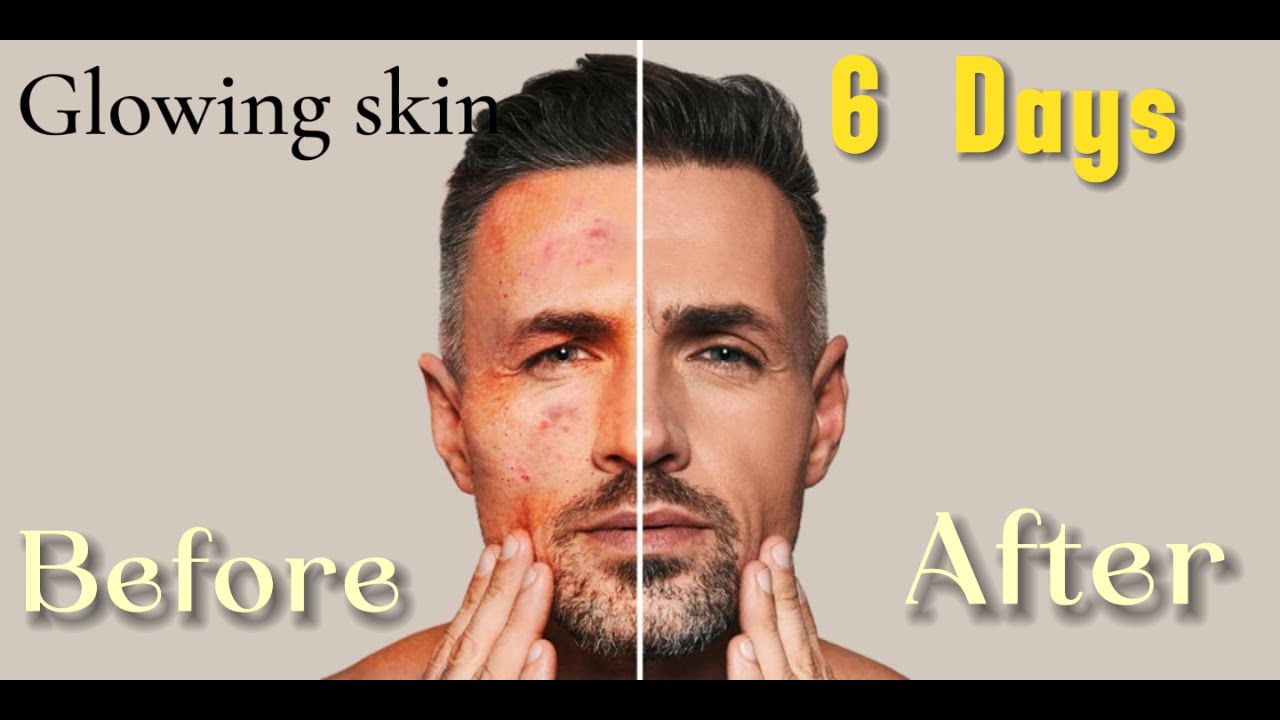 Get Glowing Skin FAST with This Simple Home Remedy! SKIN CARE