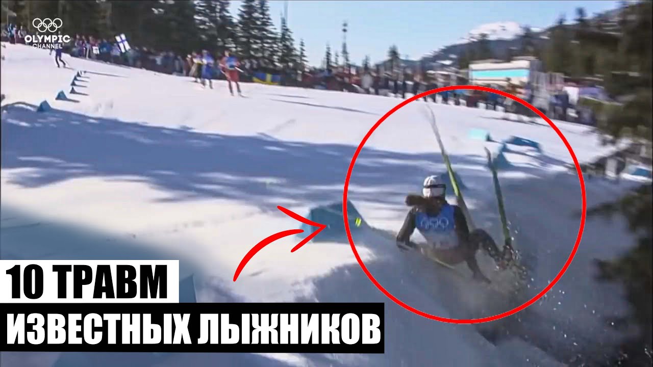 Самые страшные травмы лыжников, с которыми им пришлось выступать на соревнованиях!
